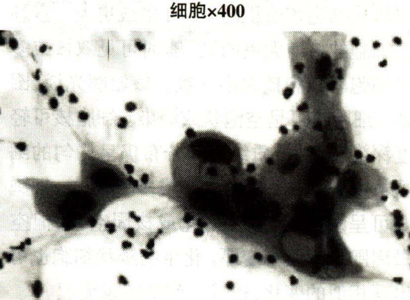 第四章 宮頸非腫瘤性細(xì)胞學(xué)改變